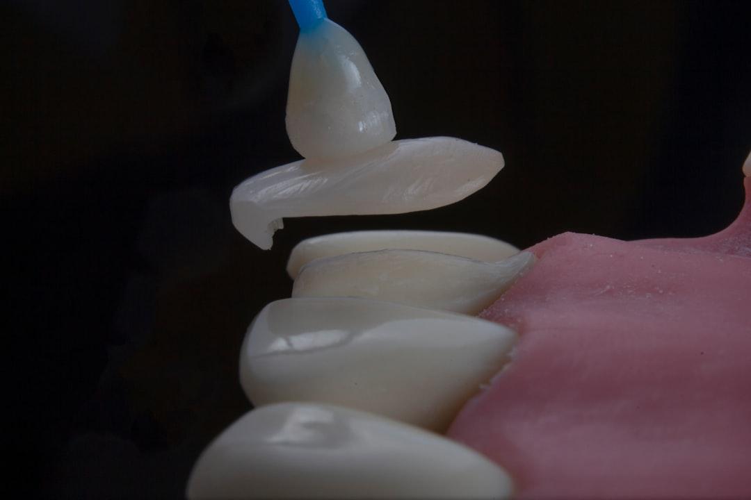 Dental Implant Surgery Billing Agreement